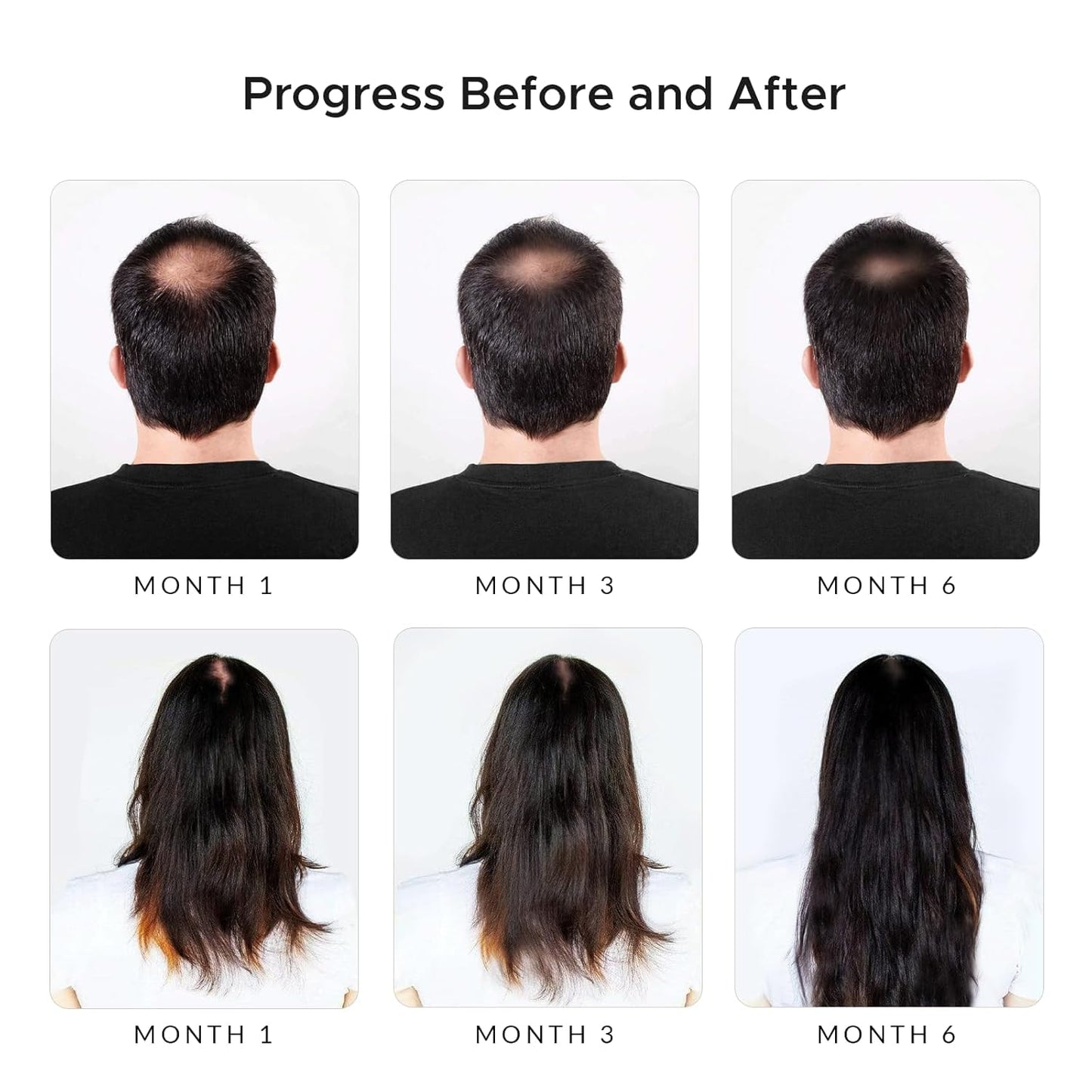 Rivermint Shampoo with Minoxidil, Hyaluronic Acid & Biotin – Hair Growth Stimulant for Men & Women, Anti Hair Loss